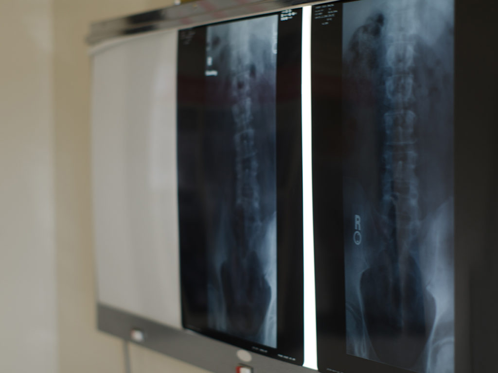 レントゲン写真